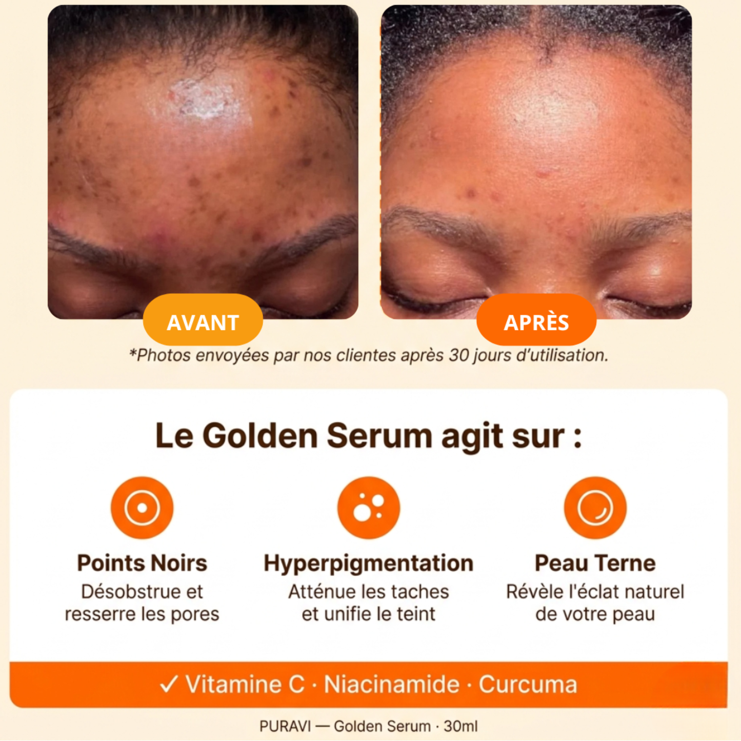 Golden Serum — Sérum Hydratant Visage Vitamine C & Curcuma