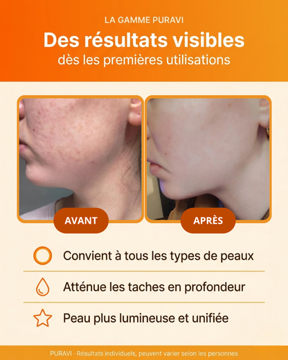 Glow Pads — Disques Nettoyants & Exfoliants au Curcuma
