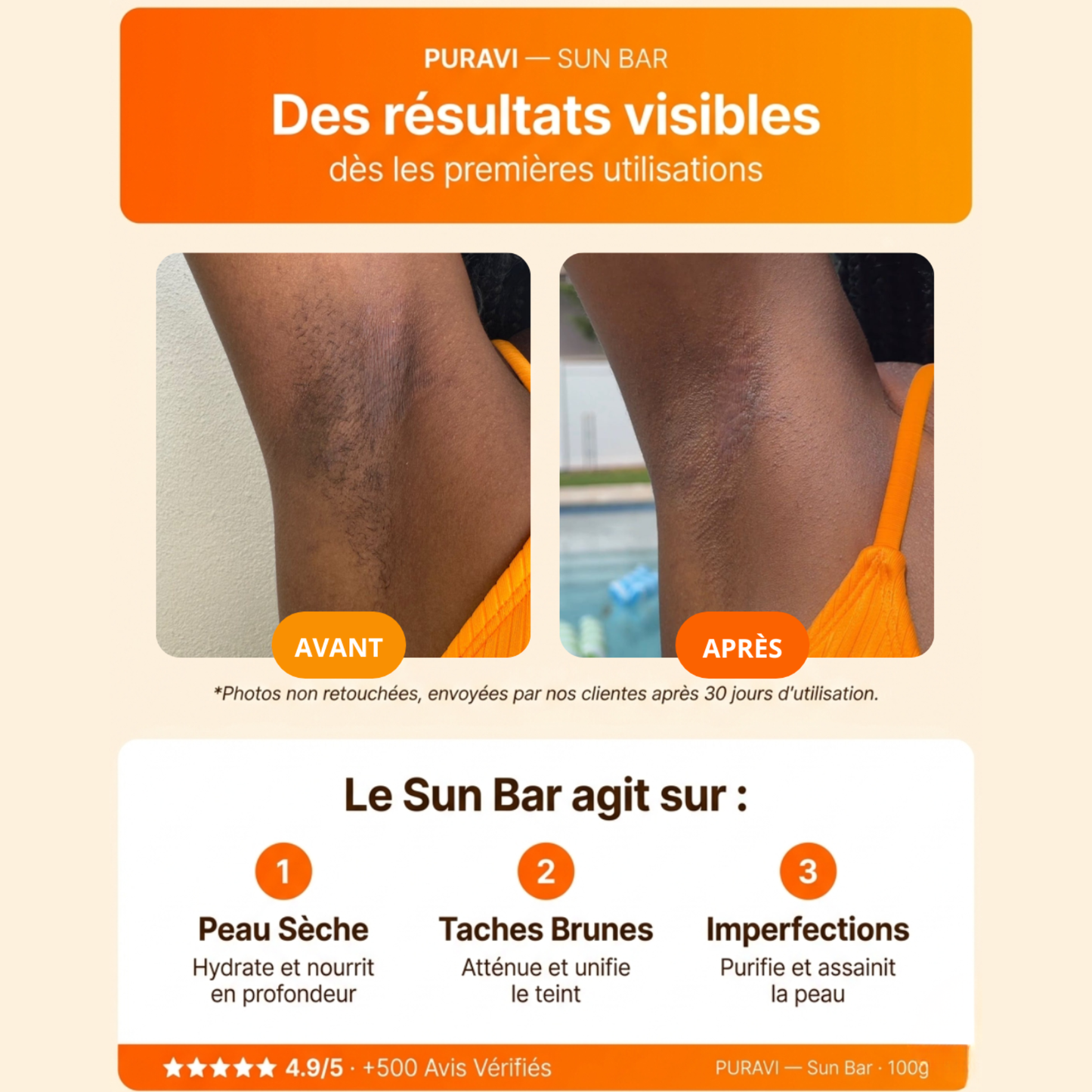 Sun Bar — Savon Artisanal Curcuma · Citron · Acide Kojique