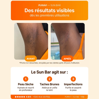 Sun Bar — Savon Artisanal Curcuma · Citron · Acide Kojique