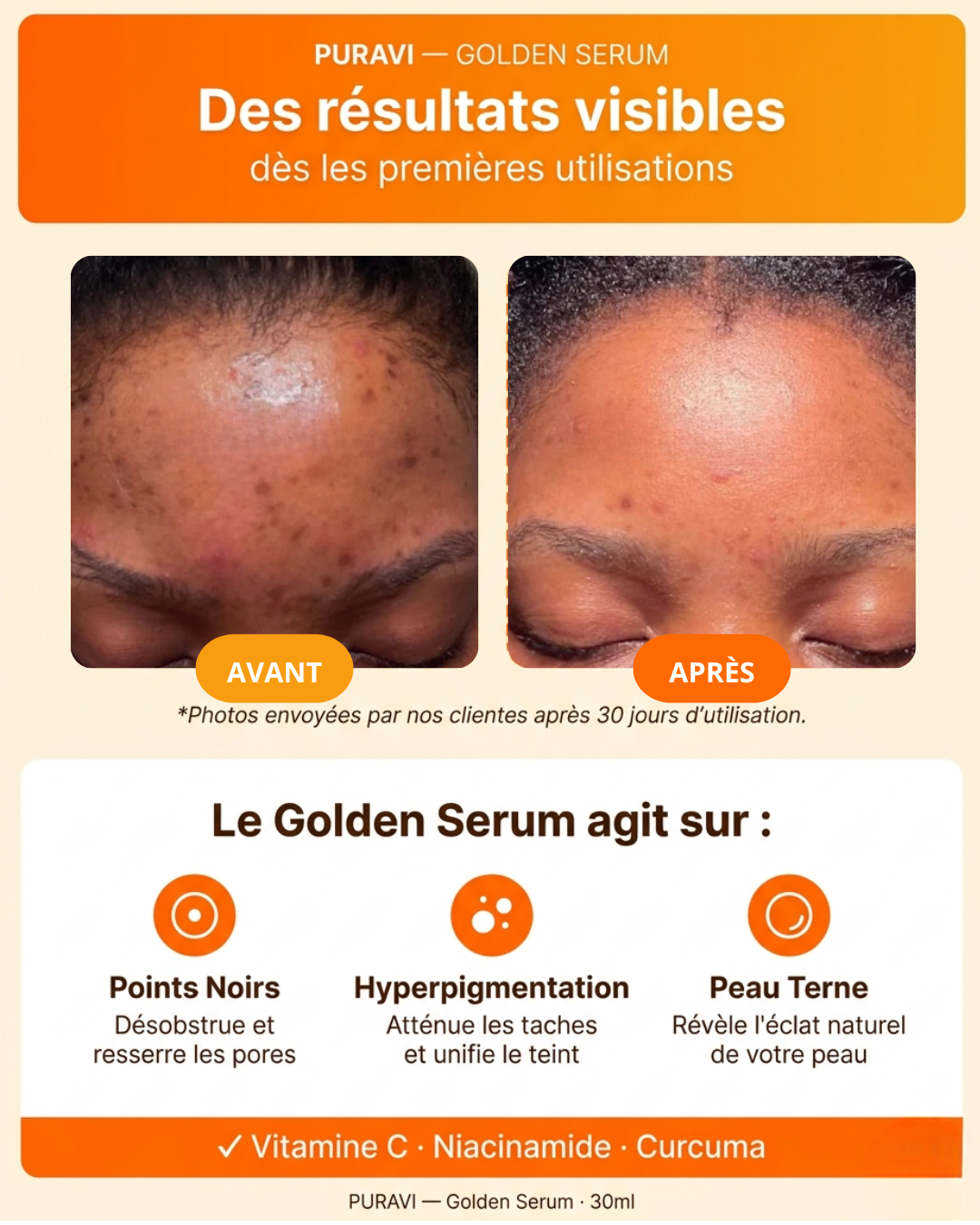 Golden Serum — Sérum Hydratant Visage Vitamine C & Curcuma