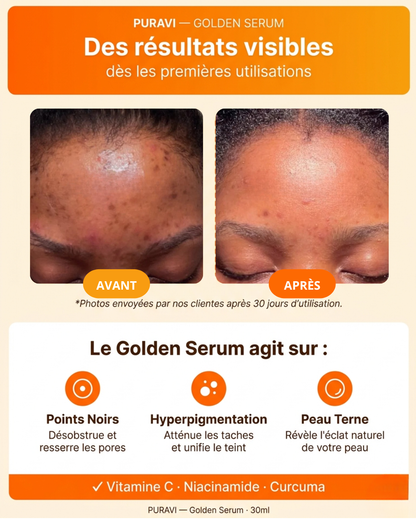 Golden Serum — Sérum Hydratant Visage Vitamine C & Curcuma