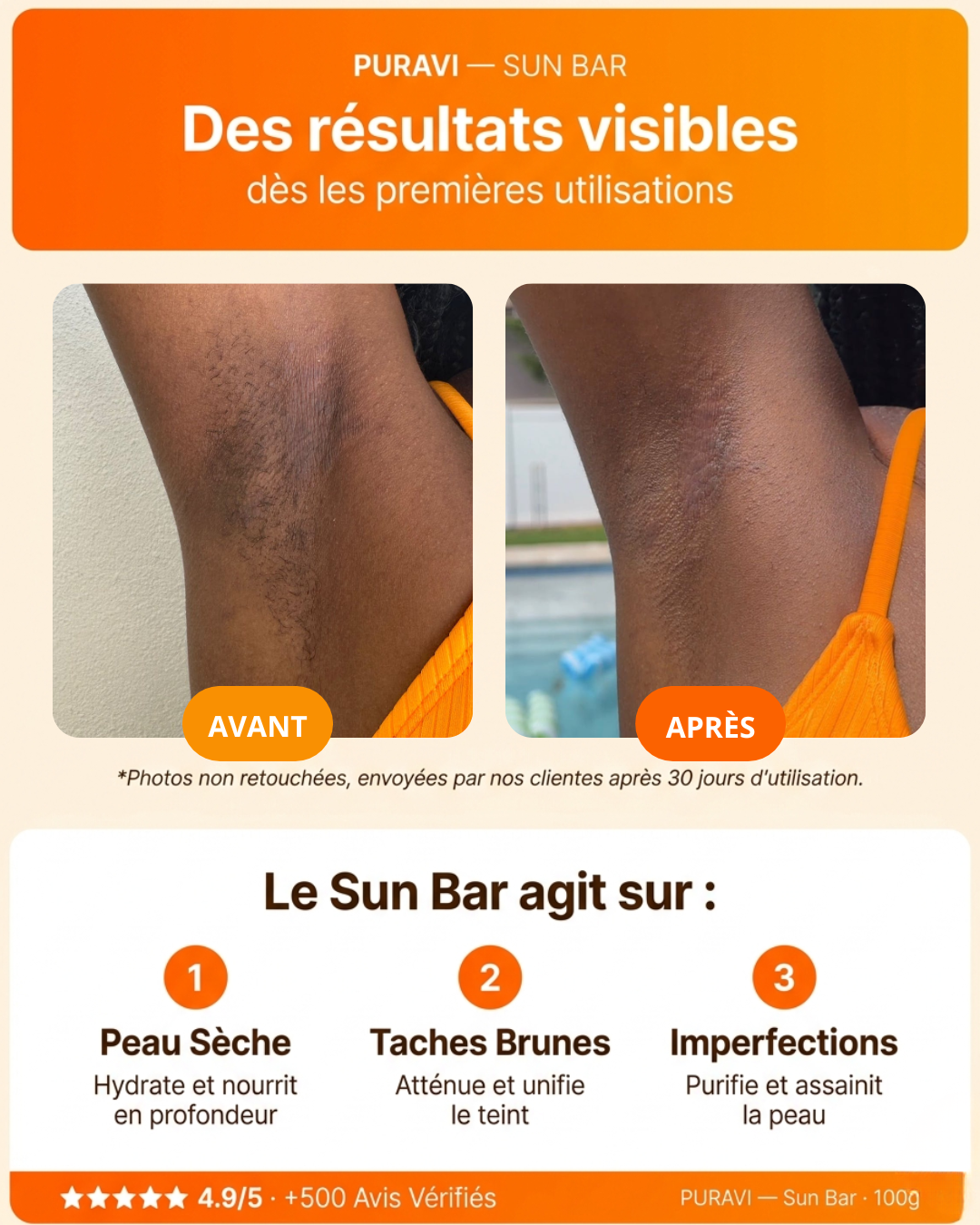 Sun Bar — Savon Artisanal Curcuma · Citron · Acide Kojique