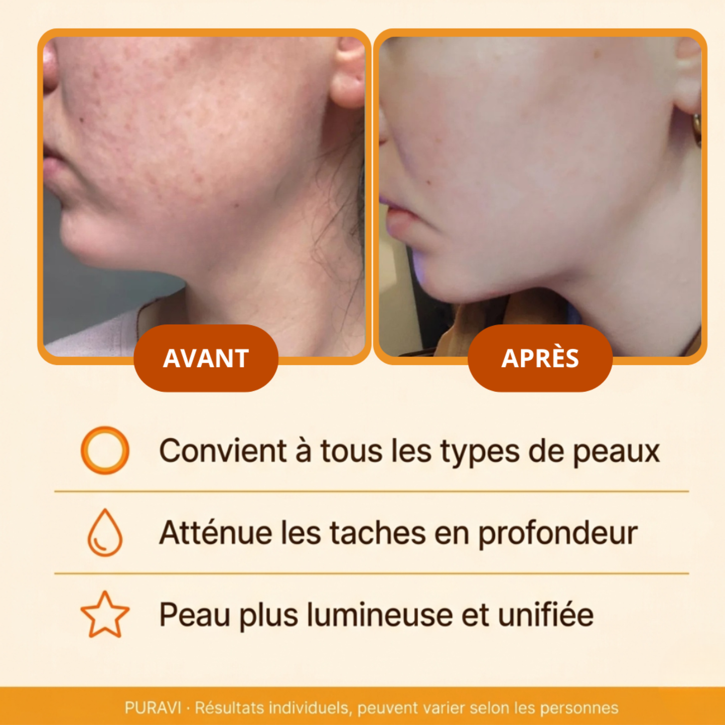 Glow Pads — Disques Nettoyants & Exfoliants au Curcuma