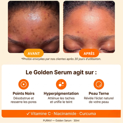 Golden Serum — Sérum Hydratant Visage Vitamine C & Curcuma